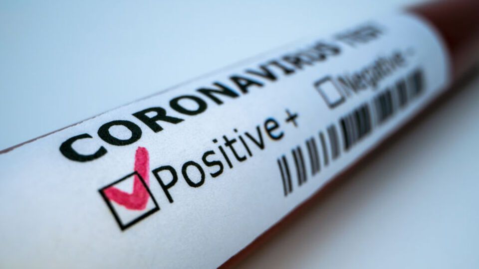 Лідирують за поширенням захворювання Київ та Чернівецька область