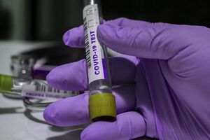 Выздоровел от COVID-19 уже 181 пациент, в том числе 19 детей