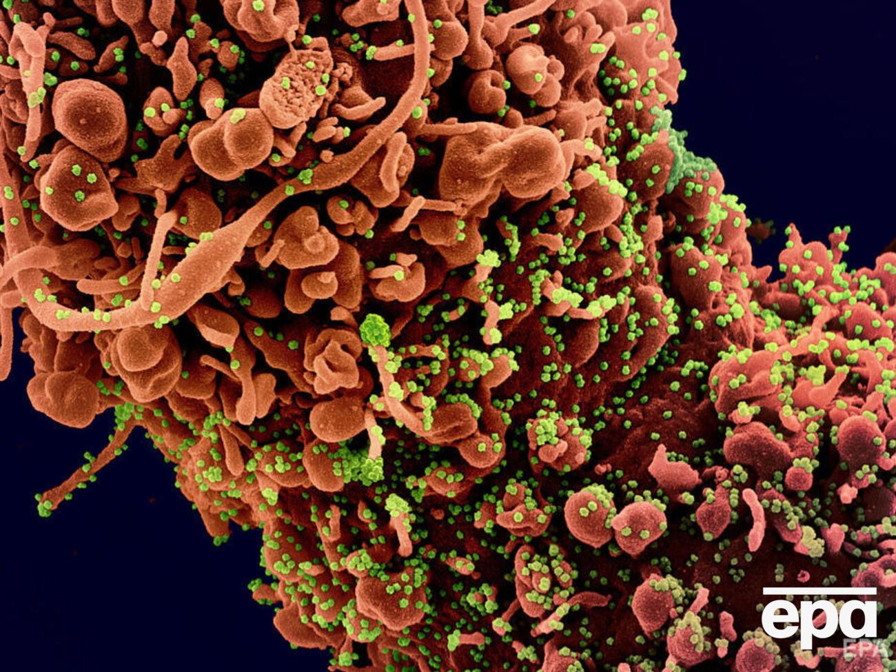 В Уханьском институте вирусологии заверили, что в геноме SARS-CoV-2 нет следов человеческого вмешательства