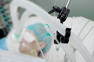 Степанов розповів, що МОЗ закупить апарати ШВЛ в українських виробників