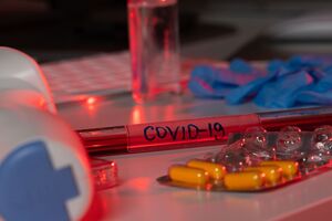 У 28 жителів Закарпаття підтверджено діагноз COVID-19