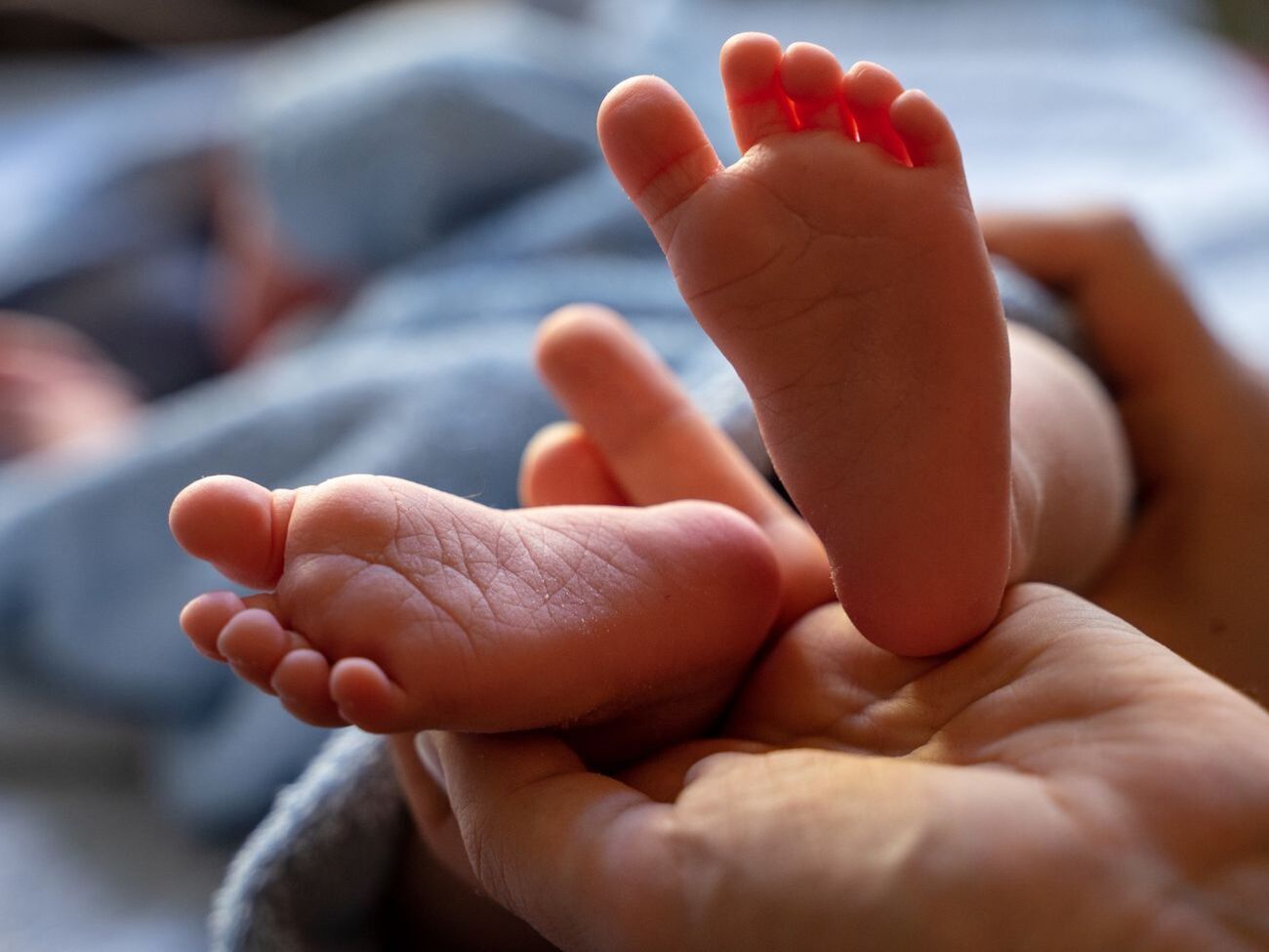 У ребенка диагностировали пневмонию, он находится на искусственной вентиляции легких