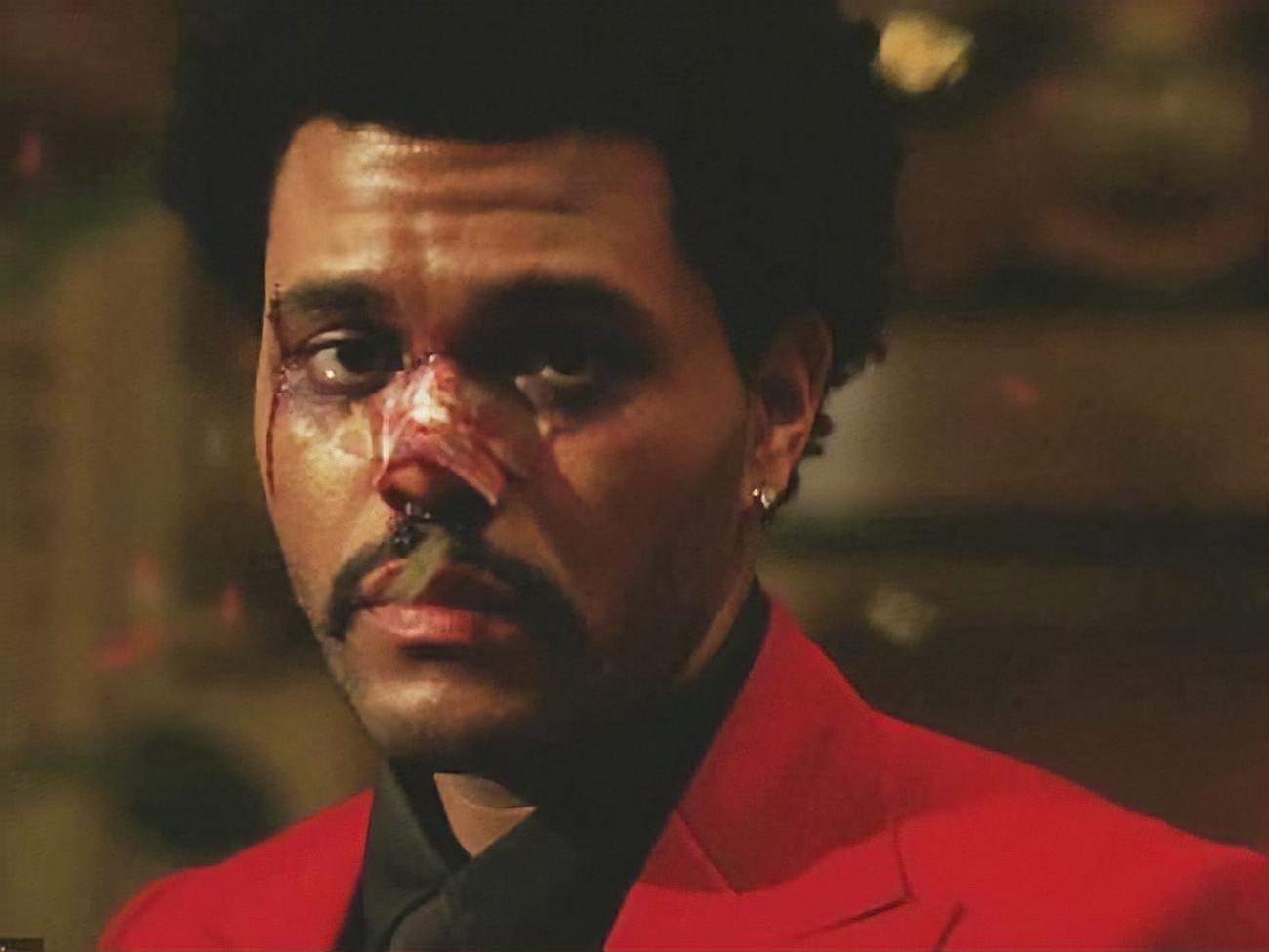 У ролику співак з'являється зі слідами побоїв на обличчі