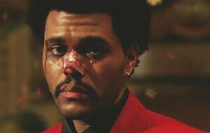 У ролику співак з'являється зі слідами побоїв на обличчі