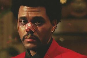 У ролику співак з'являється зі слідами побоїв на обличчі