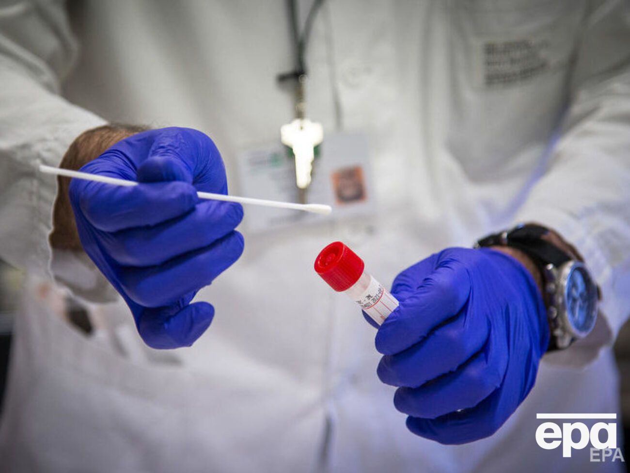 Більше ніж 86% усіх зареєстрованих випадків COVID-19 припадає на 18 країн