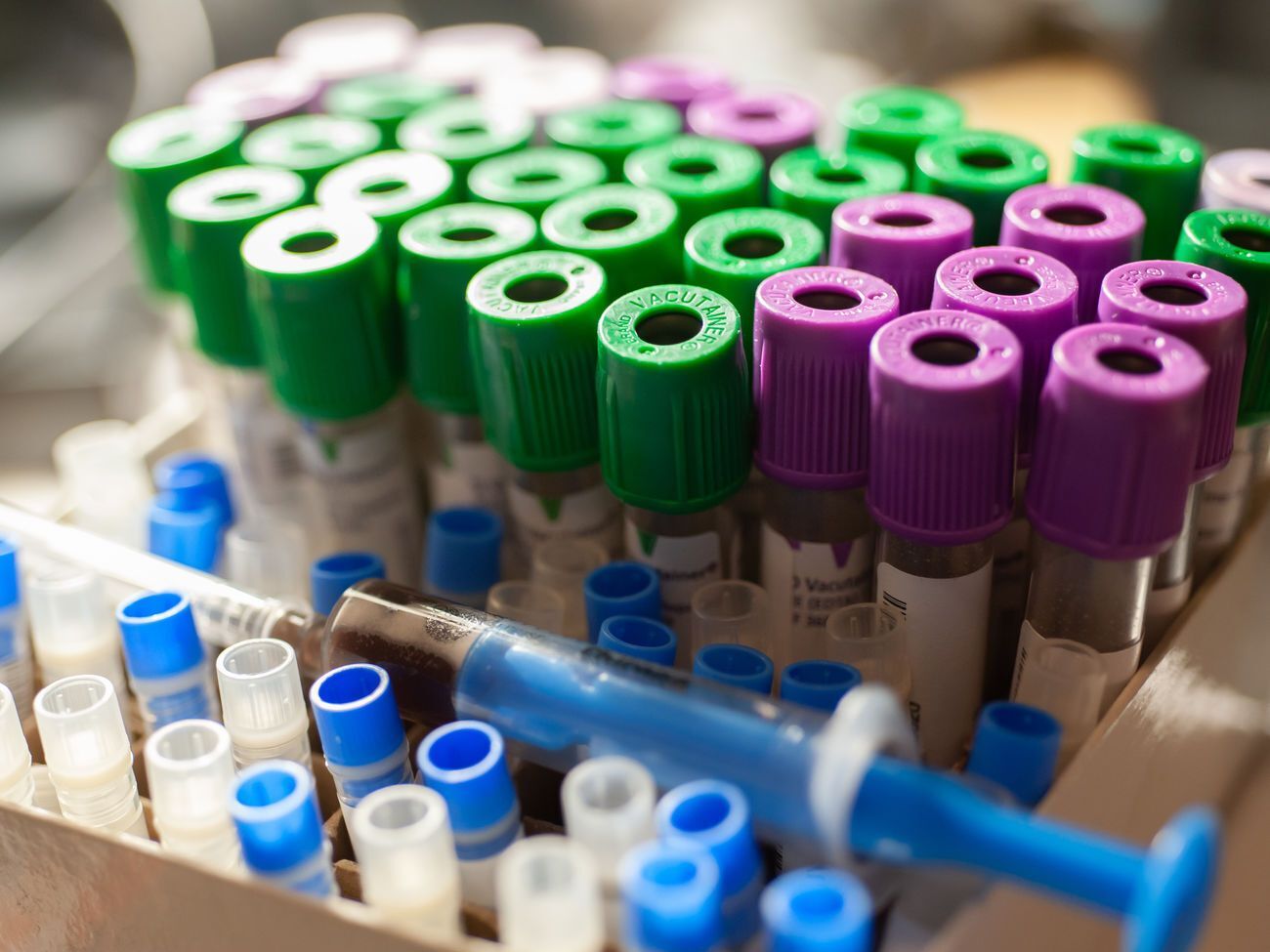 С начала эпидемии коронавирус подтвердили более чем у 15 тыс. украинцев