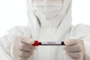 Спалах коронавірусної інфекції COVID-19 виник наприкінці 2019 року в китайському Ухані