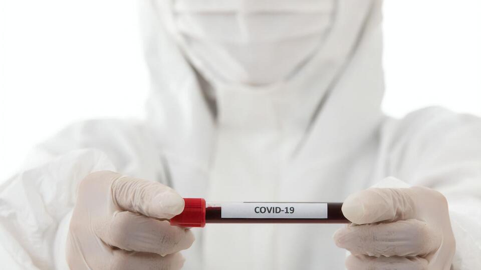 Спалах коронавірусної інфекції COVID-19 виник наприкінці 2019 року в китайському Ухані