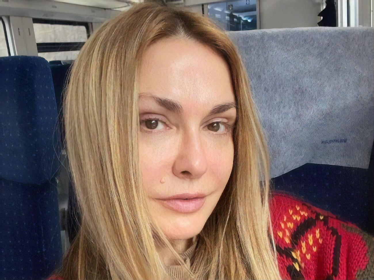 Сумська позбулася родимки