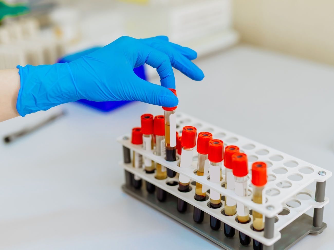 В Украине провели 267 185 тестирований на коронавирус