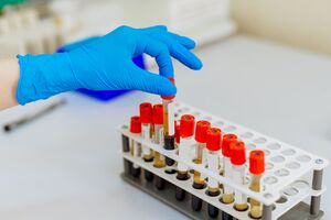 В Україні провели 267 185 тестувань на коронавірус
