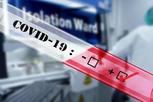 За інформацією біолога, лабораторії сильно завантажені навіть у великих містах