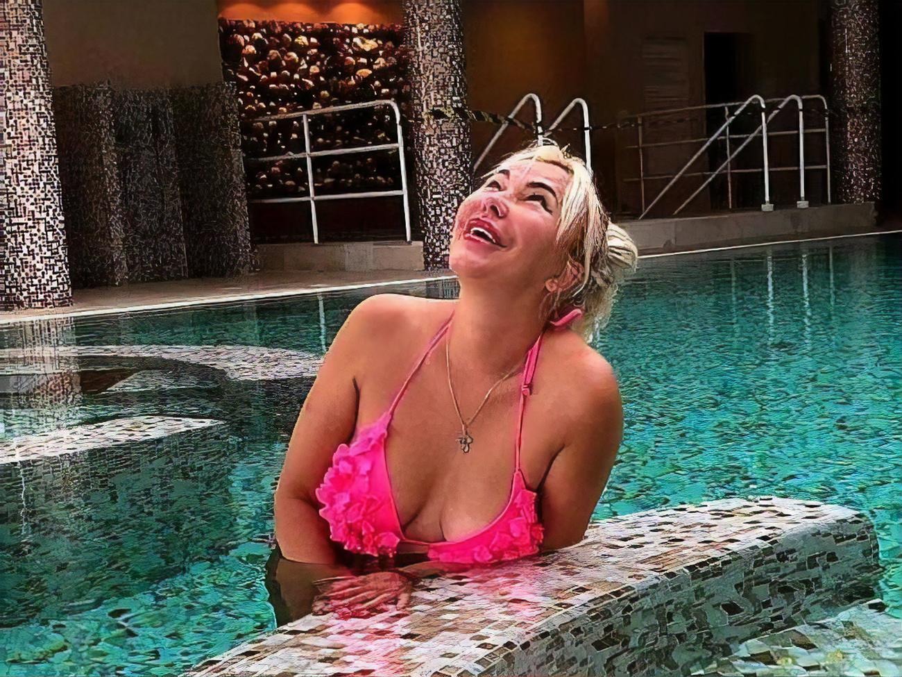 Шилова: Я розуміла, що справа йде до кінця, але до останнього не могла повірити, що силікон може ось так розливатися