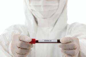 У Росії станом на 27 травня підтверджено більше ніж 370 тис. випадків захворювання на COVID-19