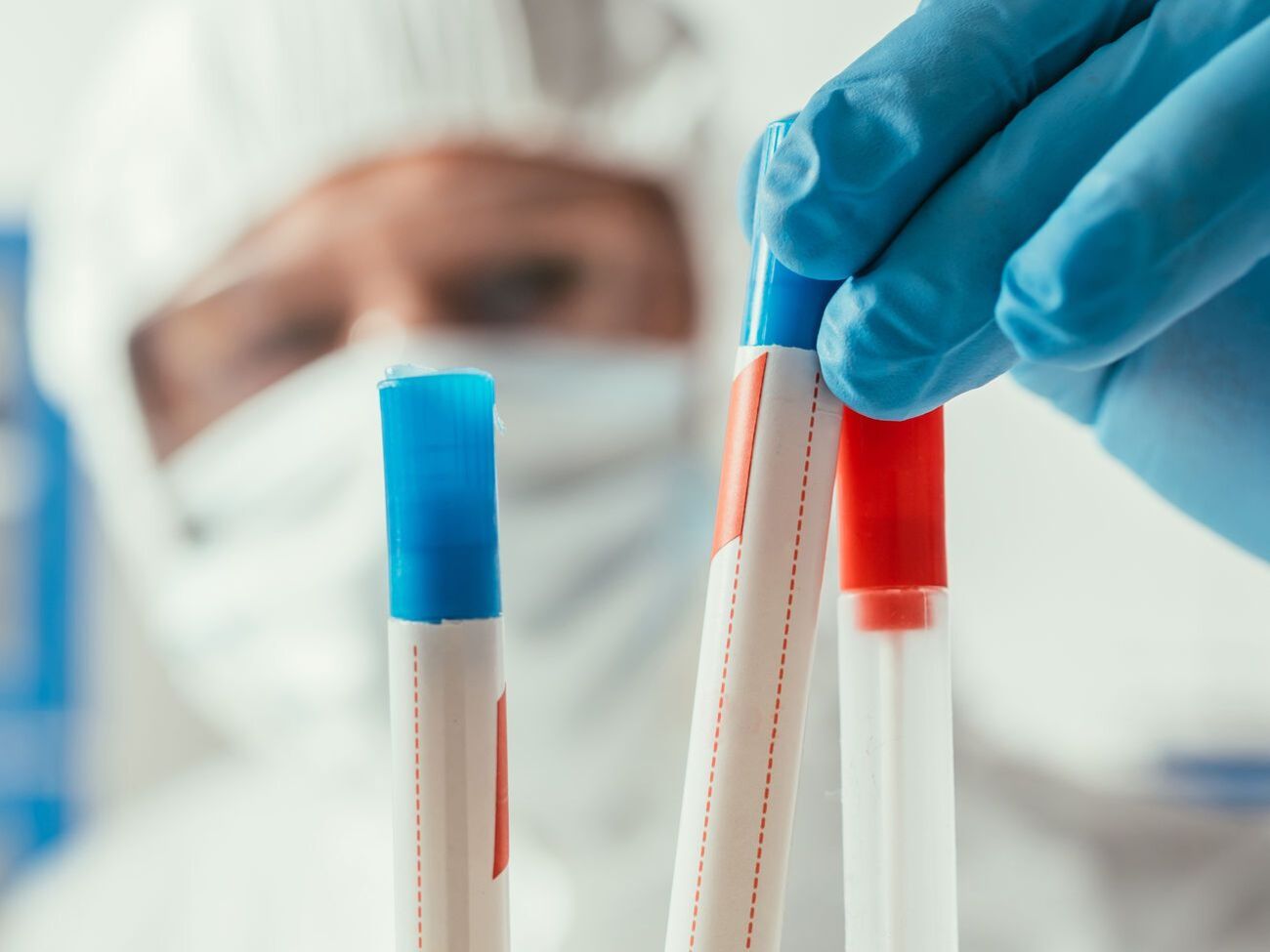 В Україні на коронавірус дослідили 322 746 зразків