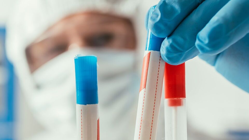 В Україні на коронавірус дослідили 322 746 зразків