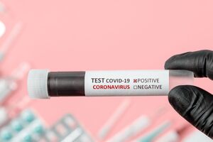 Під час ІФА-тестування аналізують сироватку крові