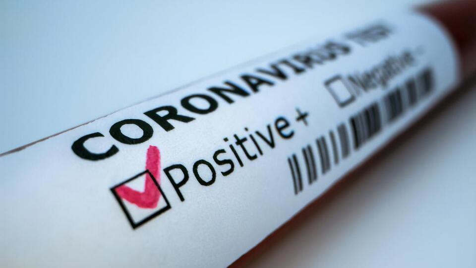 Число выздоровевших от COVID-19 уже несколько дней превышает число заболевших