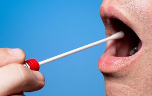 Мазок из носоглотки может не дать объективной картины наличия вируса, считают ученые из КНР