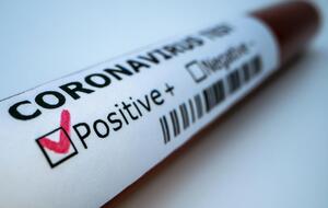 Кроме папайи, танзанийские врачи нашли коронавирус также у птицы и козы