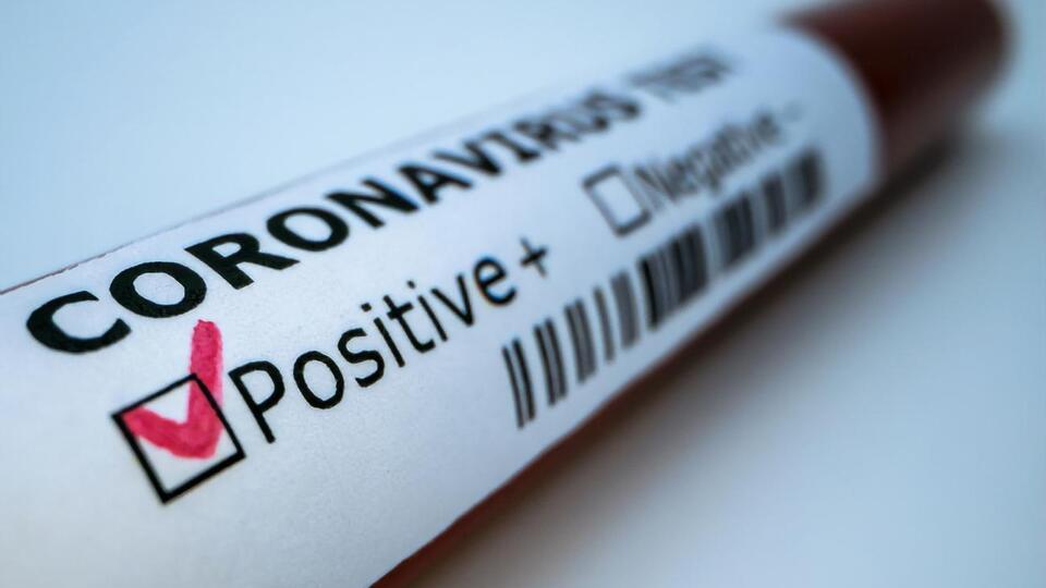 Крім папаї, танзанійські лікарі виявили коронавірус також у птиці й кози