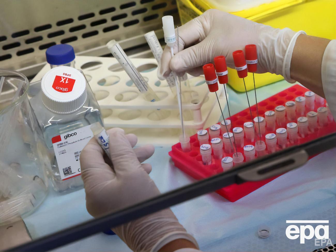 Найдено 198 разновидностей мутаций SARS-CoV-2