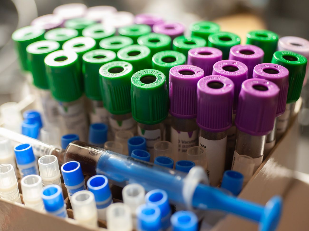 В Украине провели&nbsp;363 187 тестов на коронавирус методом ПЦР и&nbsp;10 944&nbsp;&ndash; методом ИФА&nbsp;