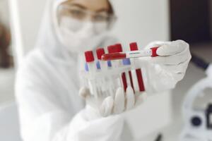 В Україні на COVID-19 захворіло 29 070 осіб