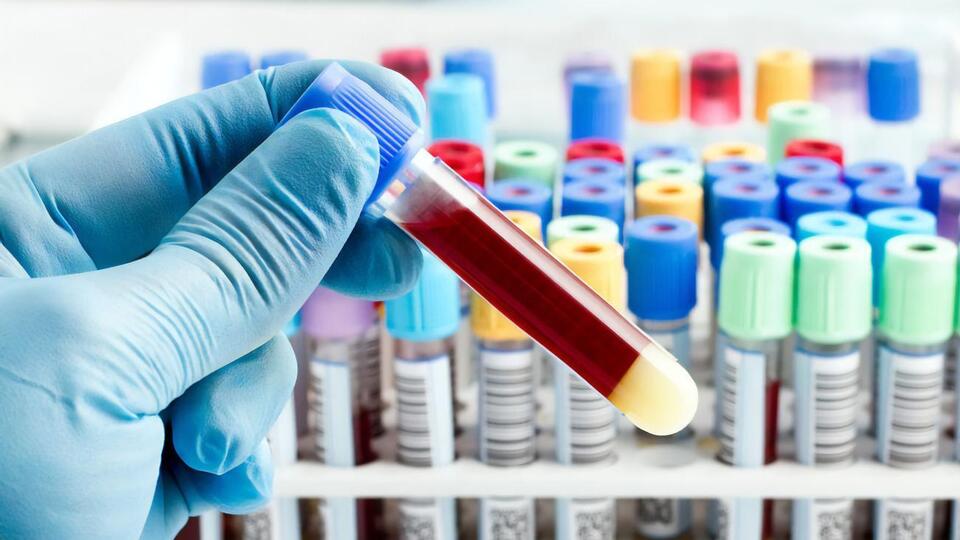 В Украине более 30 тыс. выявленных инфицированных