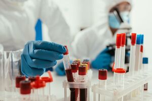 Загруженность больниц, а также количество лабораторных тестов на COVID-19 находятся в пределах допустимых норм во всех регионах Украины