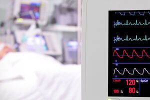 Молодого мужчину пытались реанимировать 40 минут