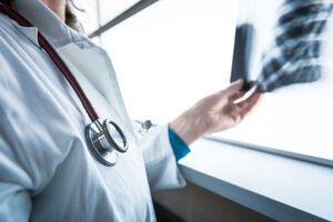 В Україні щотижня реєструють приблизно 4 тис. випадків пневмонії, це удвічі більше, ніж у травні – Степанов