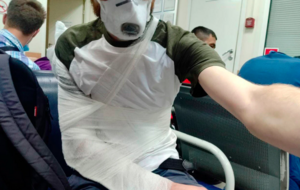 Медики подтвердили перелом руки