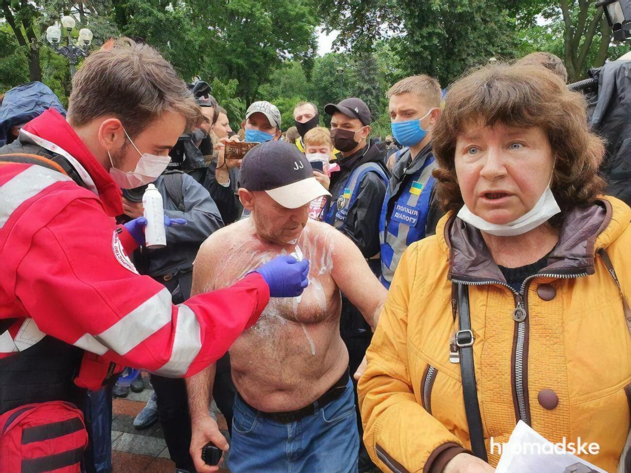 Полиции удалось быстро потушить возгорание