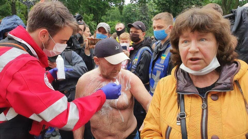 Полиции удалось быстро потушить возгорание