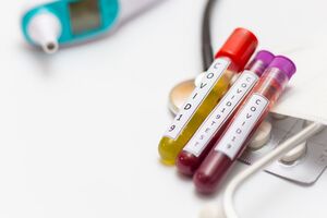 В Україні провели 431 085 тестувань на коронавірус методом ПЛР та 44 516 – методом ІФА