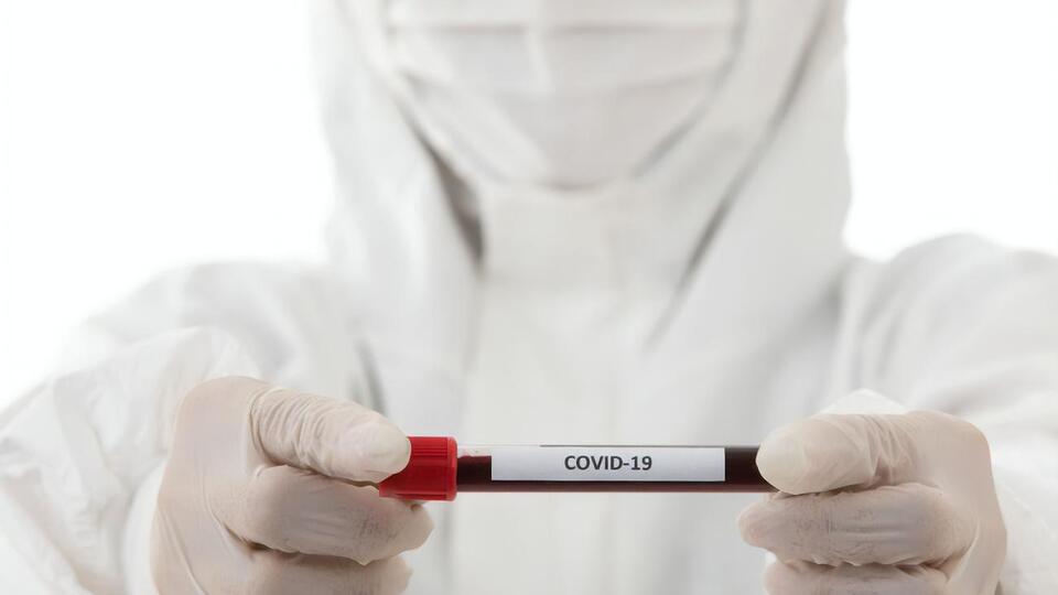 На 1 июля в Черкасской области выявлено 645 больных COVID-19