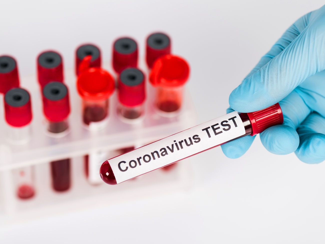 У Чернівецькій області зафіксовано 5184 випадки COVID-19