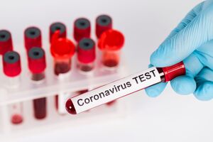 У Чернівецькій області зафіксовано 5184 випадки COVID-19
