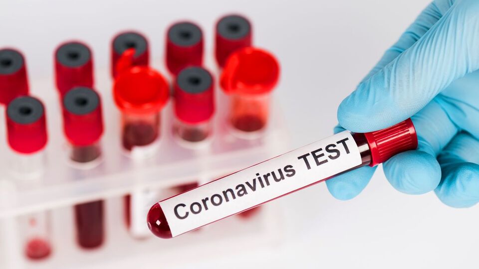 У Чернівецькій області зафіксовано 5184 випадки COVID-19