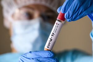 У Волинській області зафіксовано 3117 випадків COVID-19