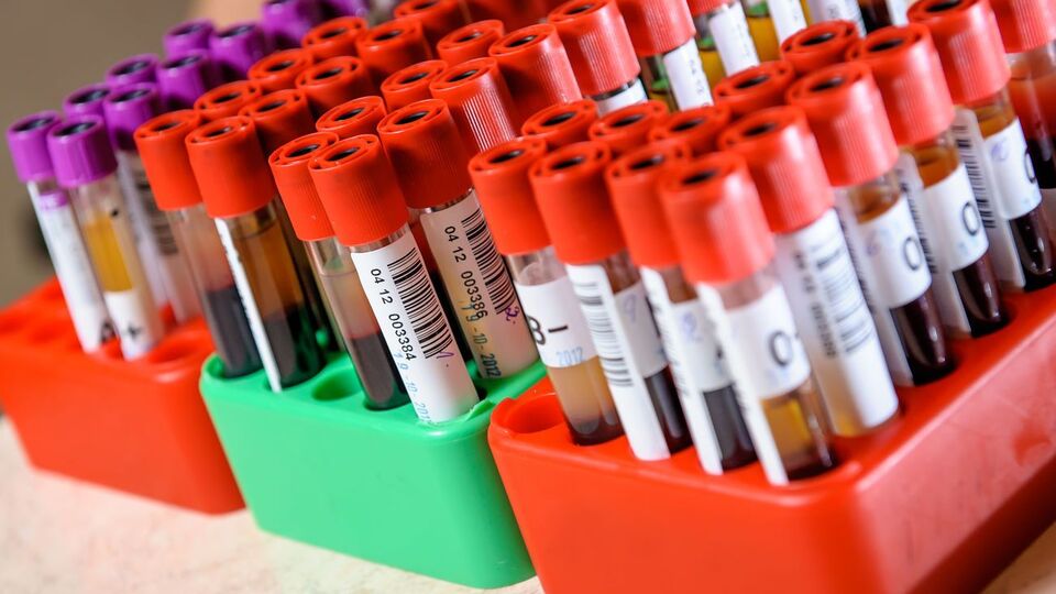Протягом доби в Україні коронавірусну інфекцію підтвердили у 829 осіб