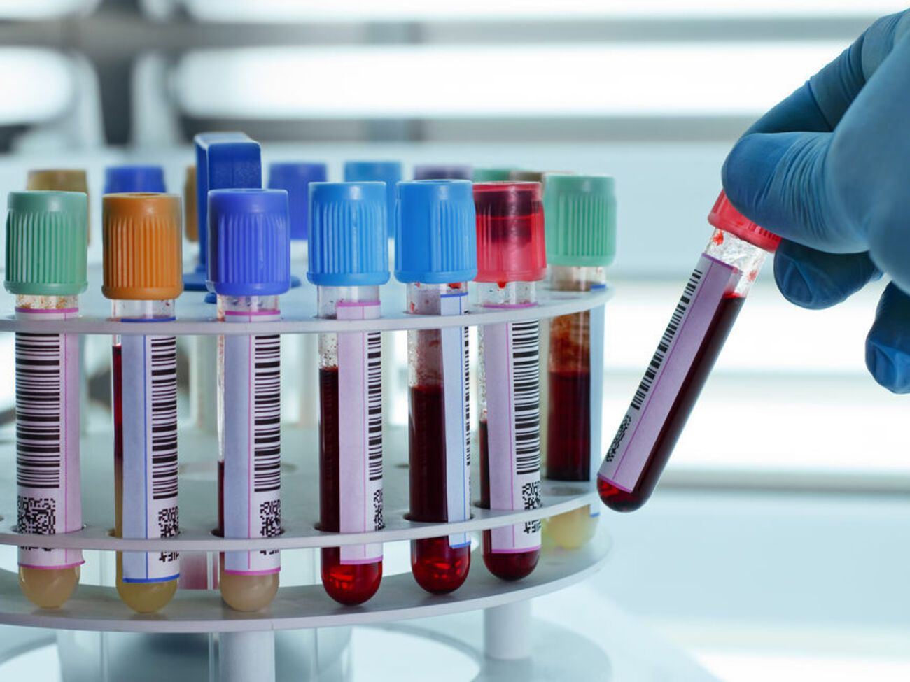 Первые случаи были обнаружены 22 июля