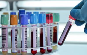 Первые случаи были обнаружены 22 июля