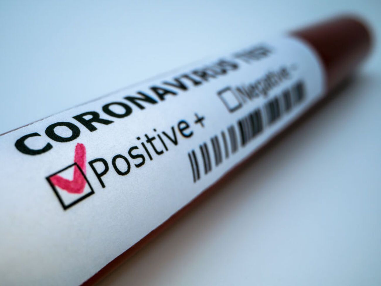 В мире зарегистрировано&nbsp;16 млн случаев заболевания&nbsp;COVID-19