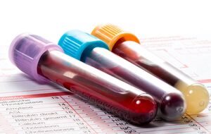 В Киеве зафиксировано 7932 случая коронавируса