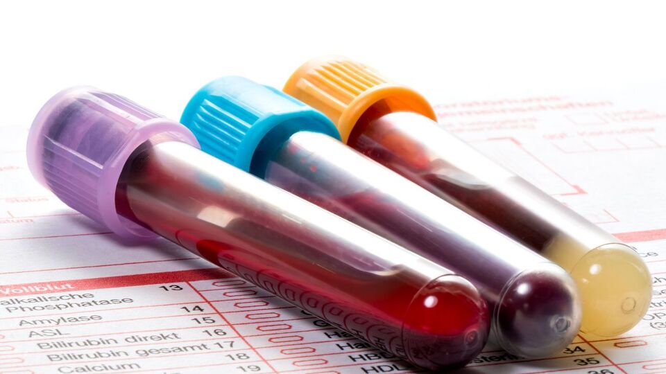 У Києві зафіксовано 7932 випадки коронавірусу