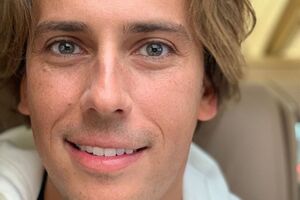 Галкін: Попелиць було виведено завчасно. Якщо хтось помітить на листочках білі патьоки, це від поливу