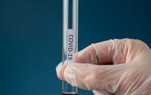 Всего за время пандемии в ВСУ выздоровел 351 военнослужащий, пятеро умерли